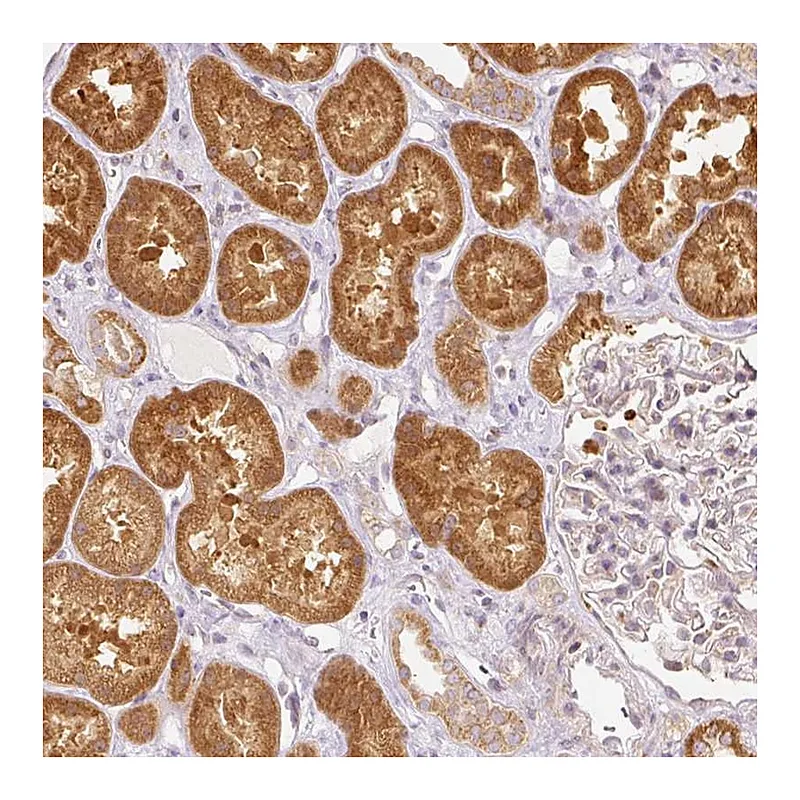 Atlas Antibodies Anti-SNAPC5 Antibody