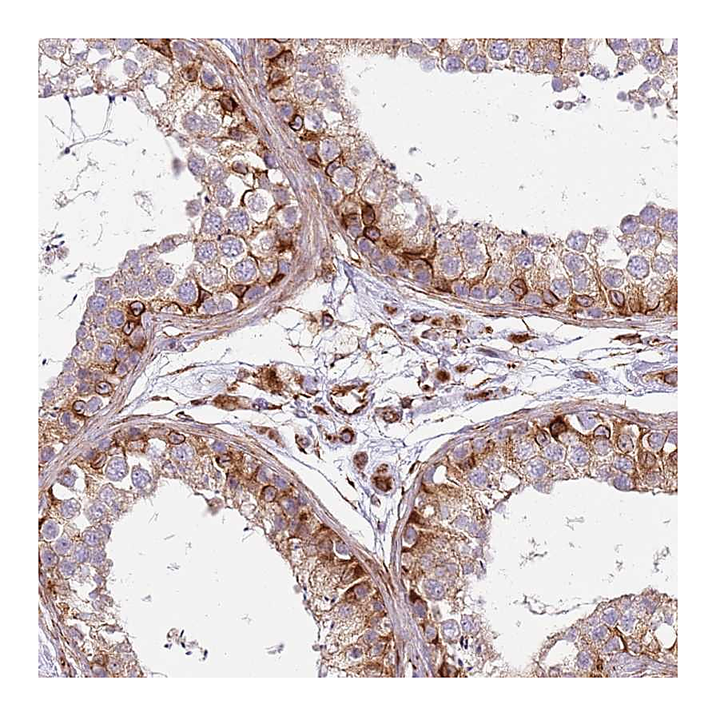 Atlas Antibodies Anti-SNAPIN Antibody