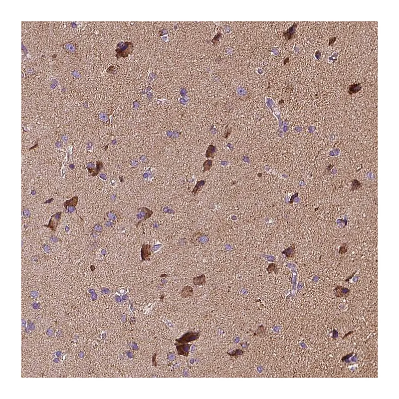 Atlas Antibodies Anti-SNCAIP Antibody