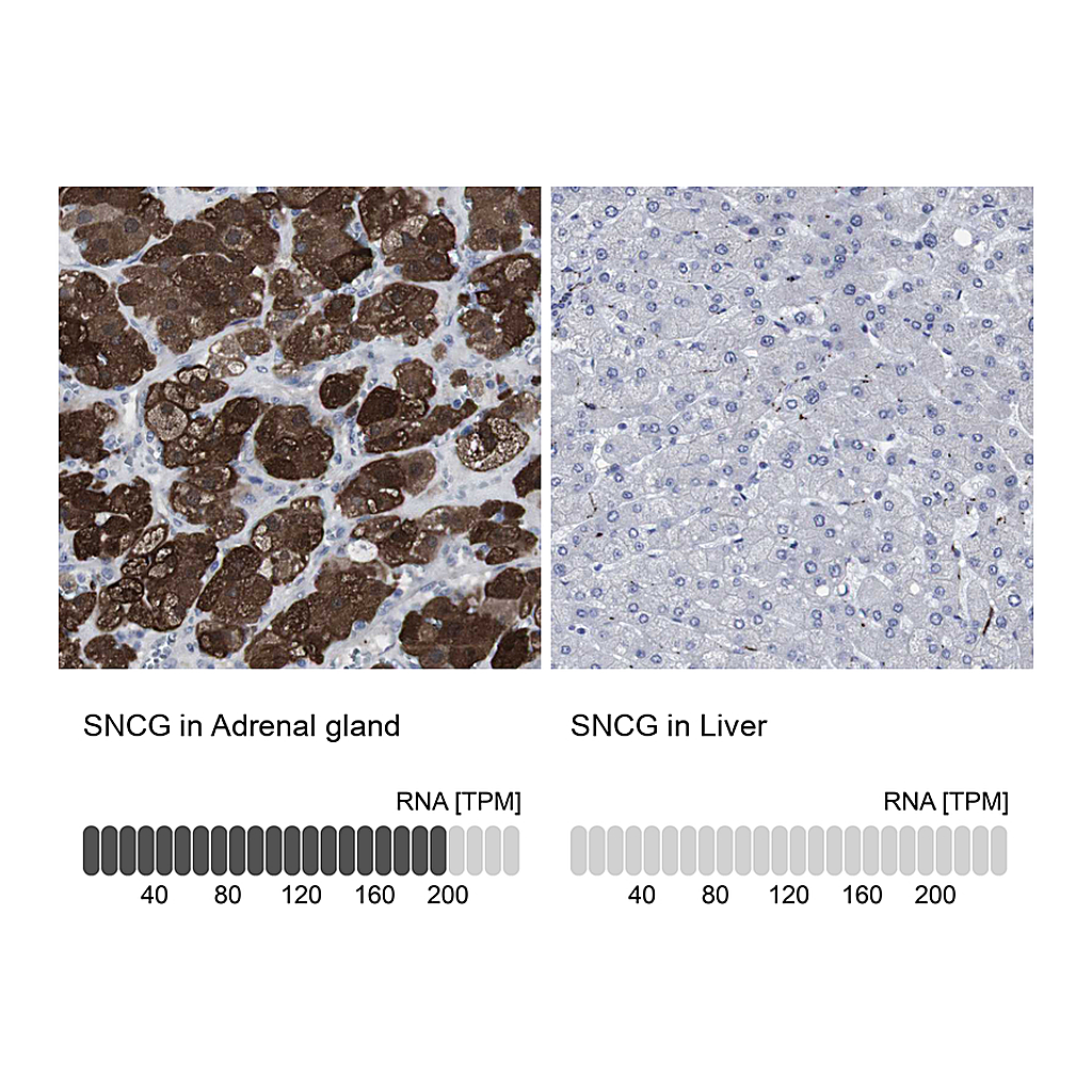 Atlas Antibodies Anti-SNCG Antibody