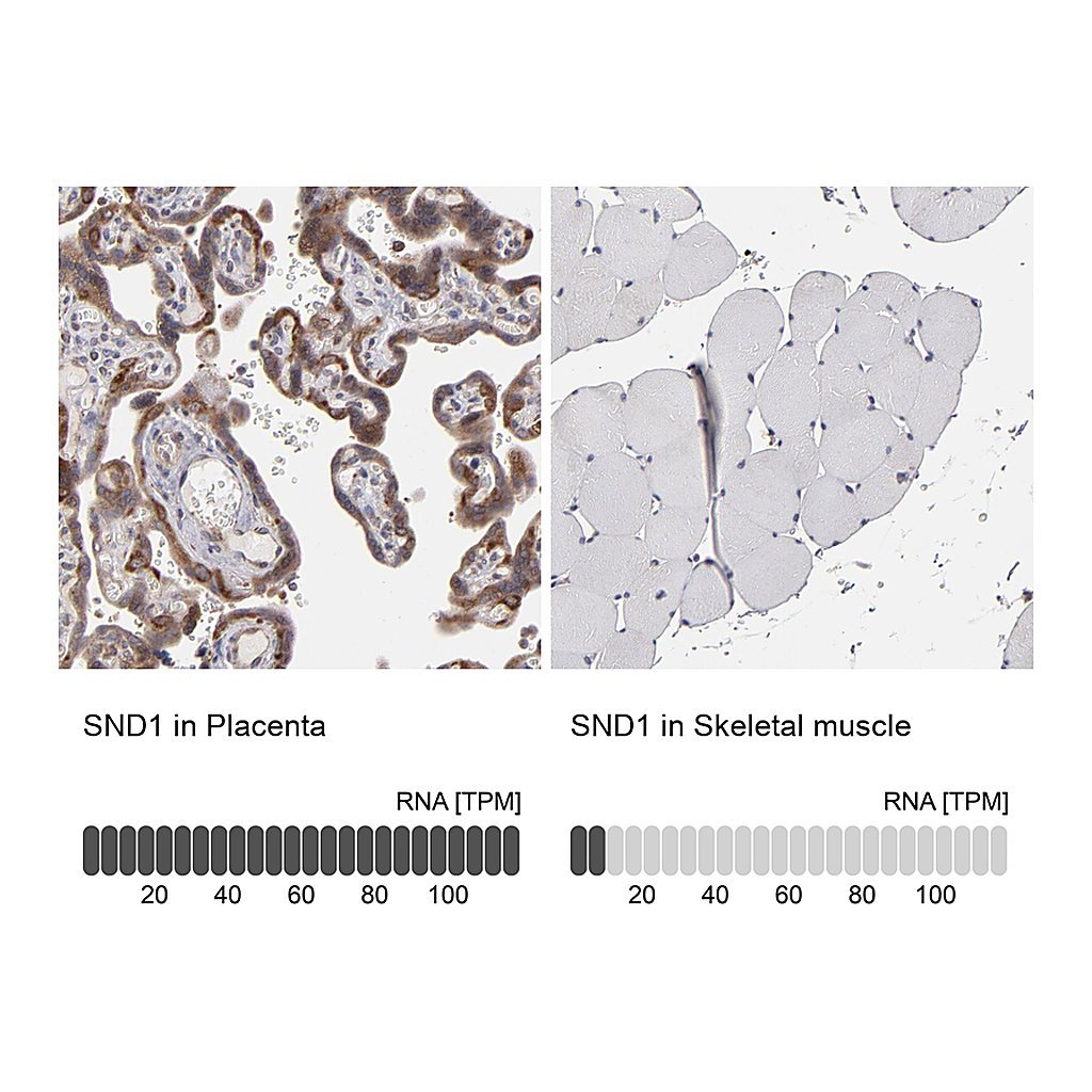 Atlas Antibodies Anti-SND1 Antibody