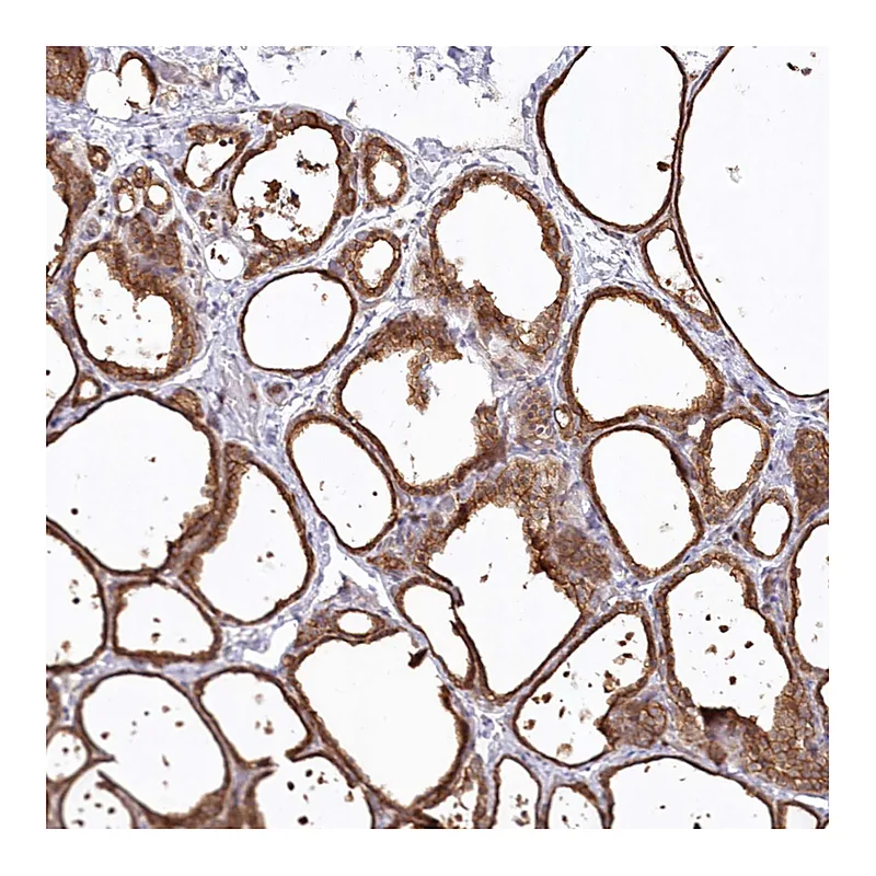 Atlas Antibodies Anti-SNED1 Antibody