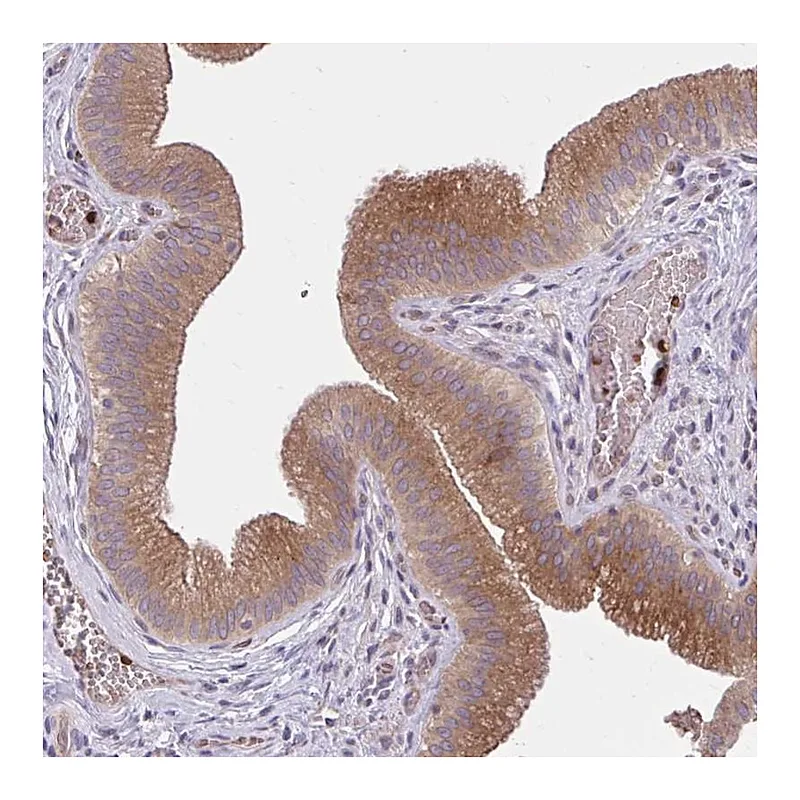 Atlas Antibodies Anti-SNF8 Antibody