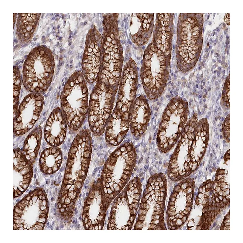 Atlas Antibodies Anti-SNED1 Antibody