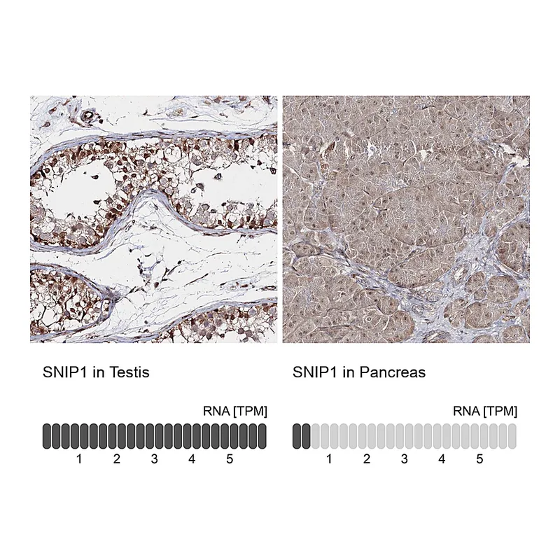 Atlas Antibodies Anti-SNIP1 Antibody