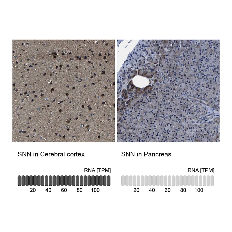 Atlas Antibodies Anti-SNN Antibody