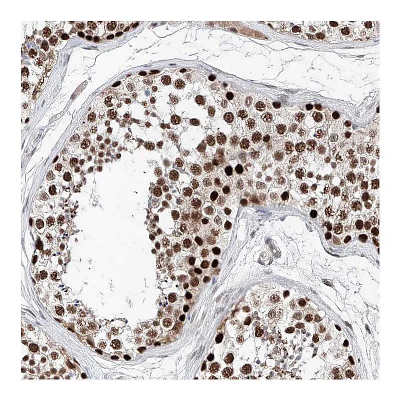 Atlas Antibodies Anti-SNRNP200 Antibody