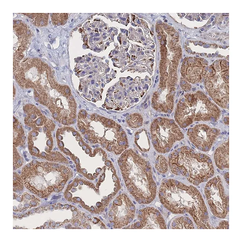 Atlas Antibodies Anti-SNPH Antibody