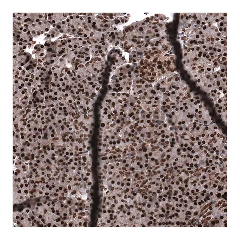Atlas Antibodies Anti-SNRK Antibody