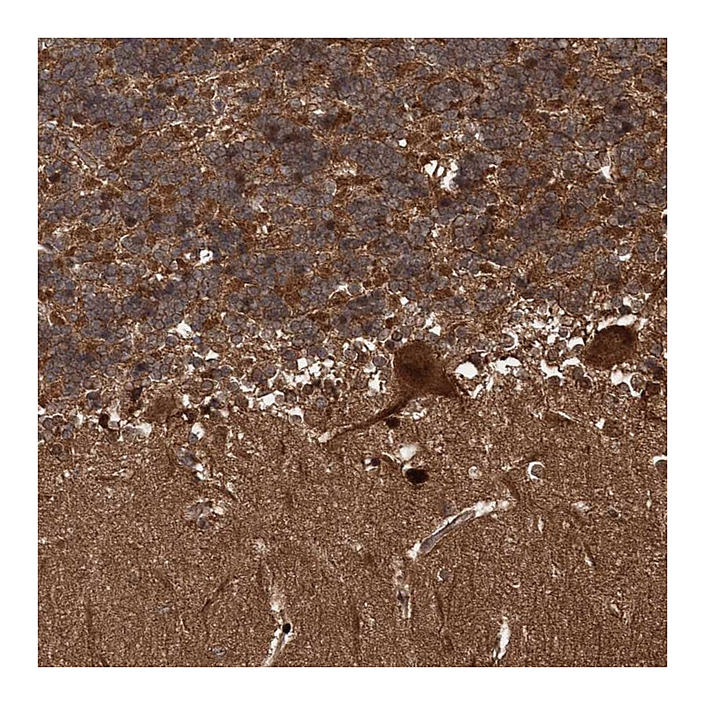 Atlas Antibodies Anti-SNRNP25 Antibody