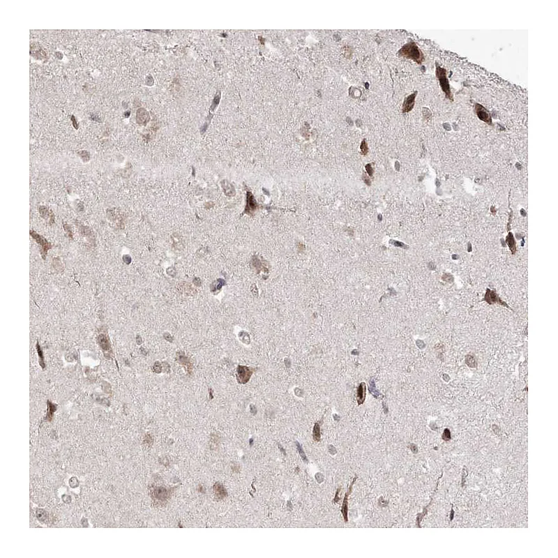 Atlas Antibodies Anti-SNRNP27 Antibody