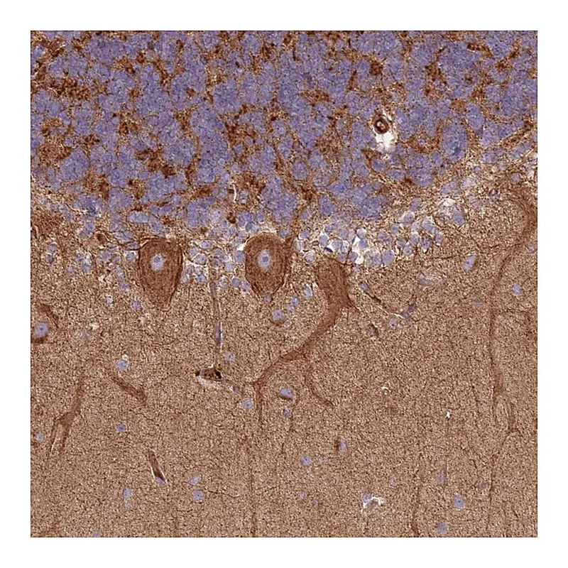 Atlas Antibodies Anti-SNRNP25 Antibody