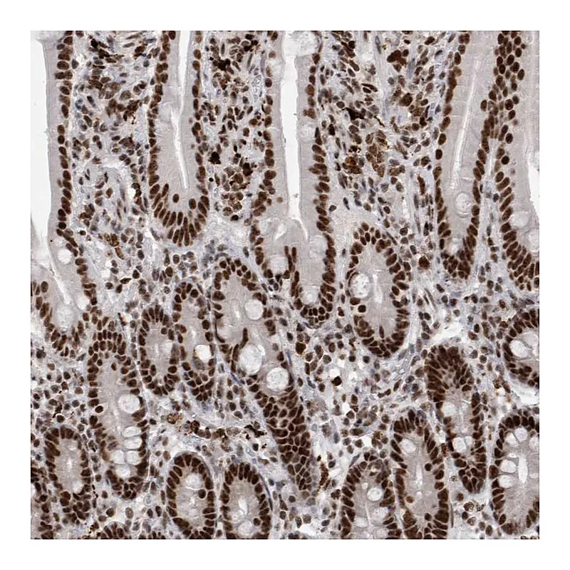 Atlas Antibodies Anti-SNRNP40 Antibody