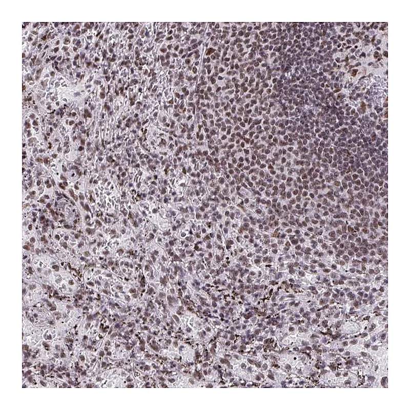 Atlas Antibodies Anti-SNRNP70 Antibody