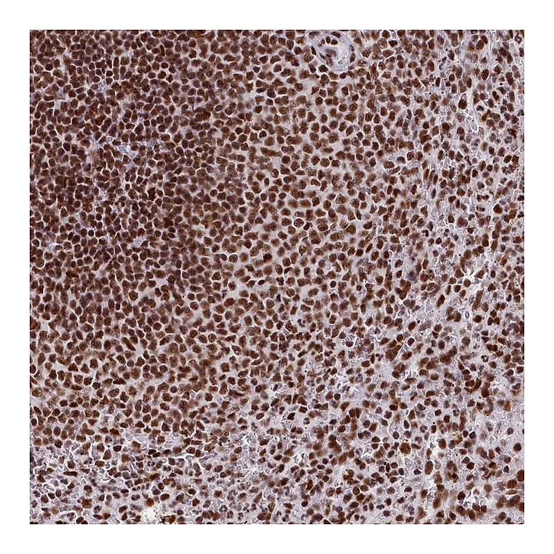 Atlas Antibodies Anti-SNRNP70 Antibody