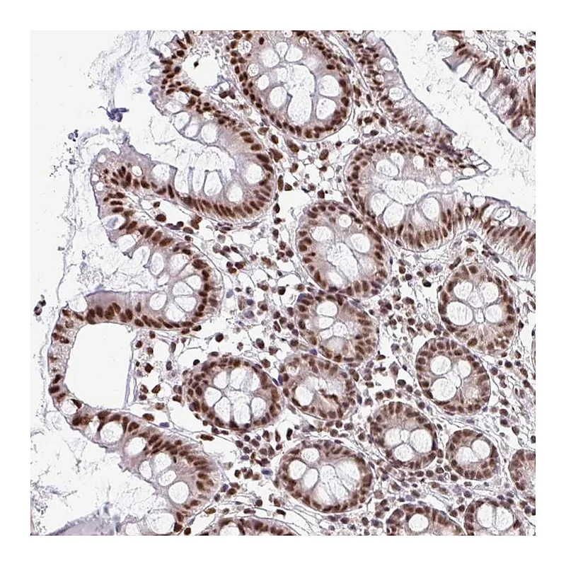 Atlas Antibodies Anti-SNRPA Antibody