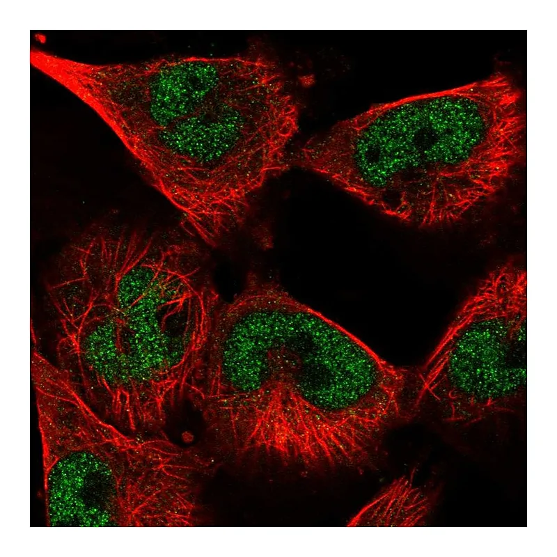 Atlas Antibodies Anti-SNRPA Antibody