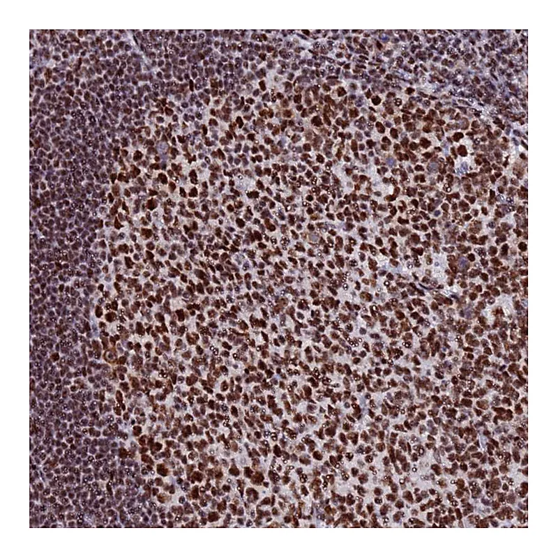 Atlas Antibodies Anti-SNRPA1 Antibody