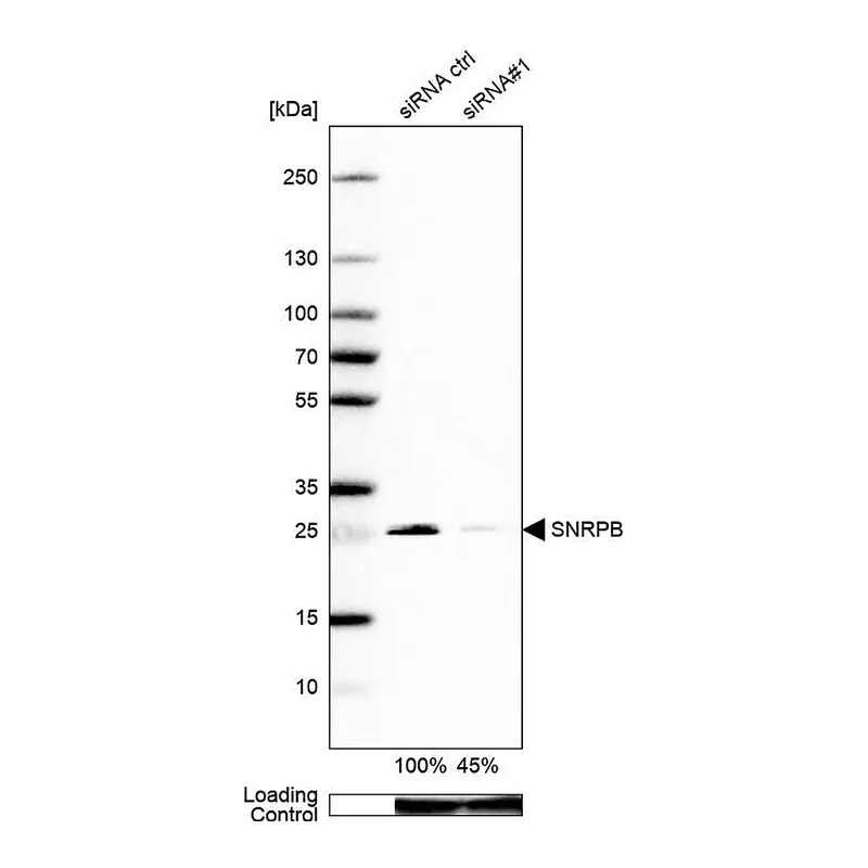 Atlas Antibodies Anti-SNRPB Antibody