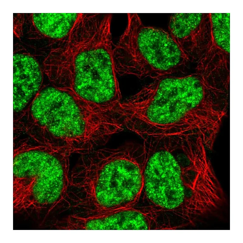 Atlas Antibodies Anti-SNRPB2 Antibody