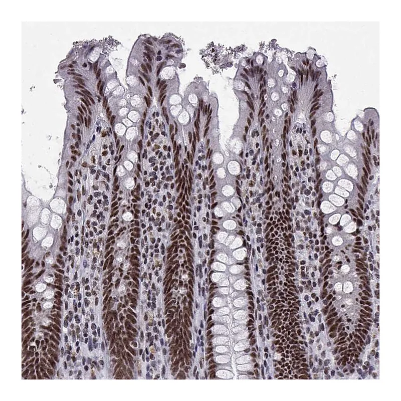 Atlas Antibodies Anti-SNRPB2 Antibody