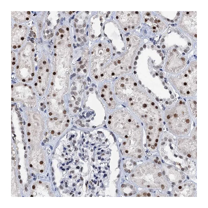 Atlas Antibodies Anti-SNRPD1 Antibody