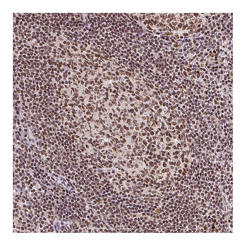Atlas Antibodies Anti-SNRPG Antibody