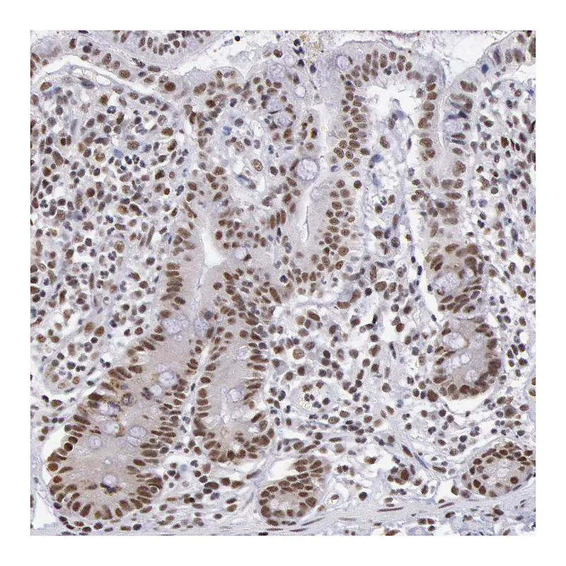 Atlas Antibodies Anti-SNRPD3 Antibody