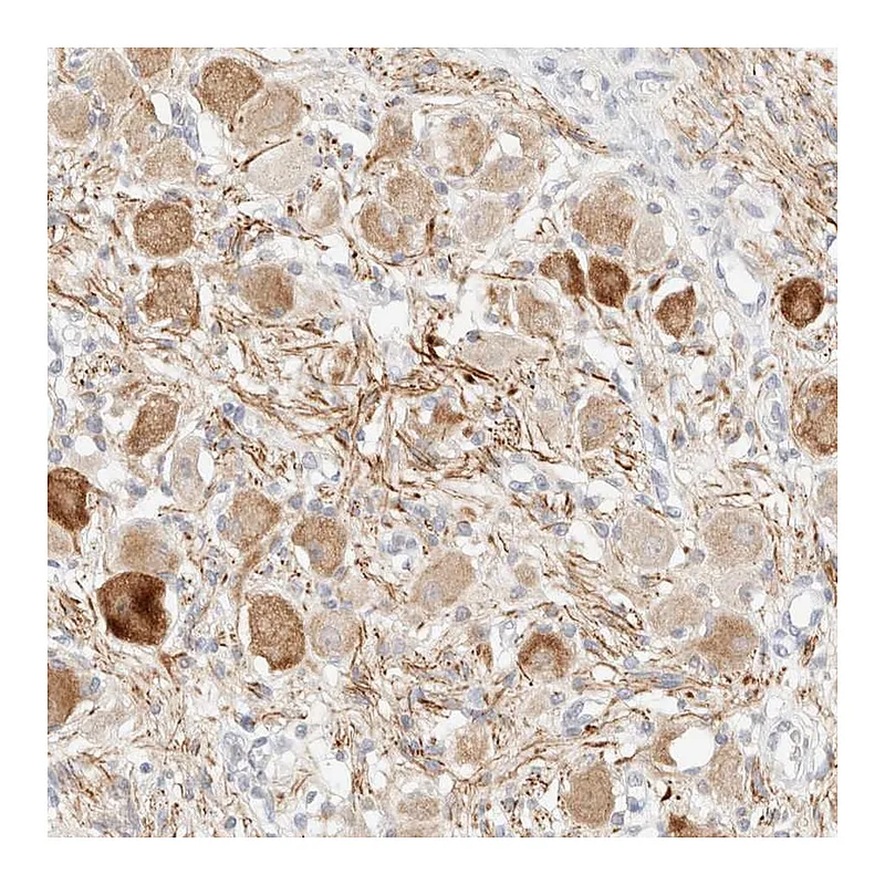 Atlas Antibodies Anti-SNTB1 Antibody