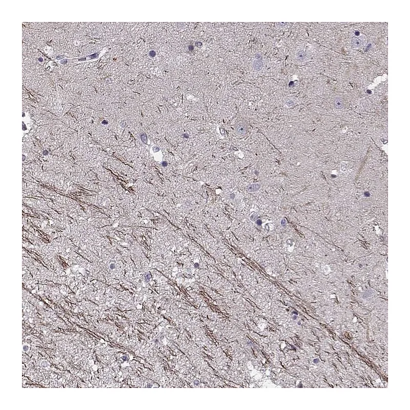 Atlas Antibodies Anti-SNTG1 Antibody
