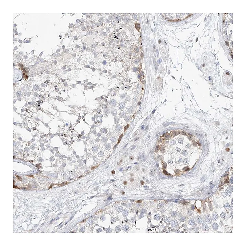 Atlas Antibodies Anti-SNU13 Antibody