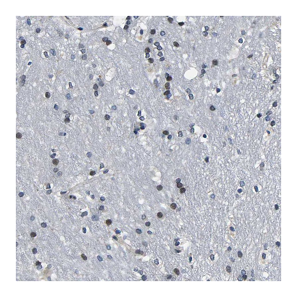 Atlas Antibodies Anti-SNX10 Antibody