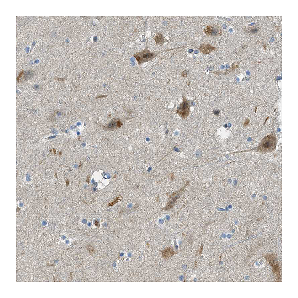Atlas Antibodies Anti-SNX14 Antibody