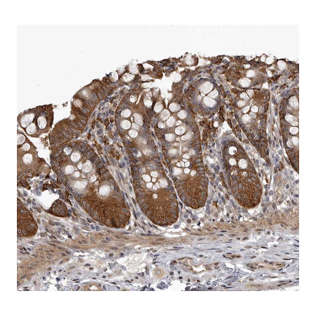 Atlas Antibodies Anti-SNX16 Antibody