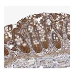 Atlas Antibodies Anti-SNX16 Antibody