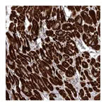 Atlas Antibodies Anti-SNX16 Antibody