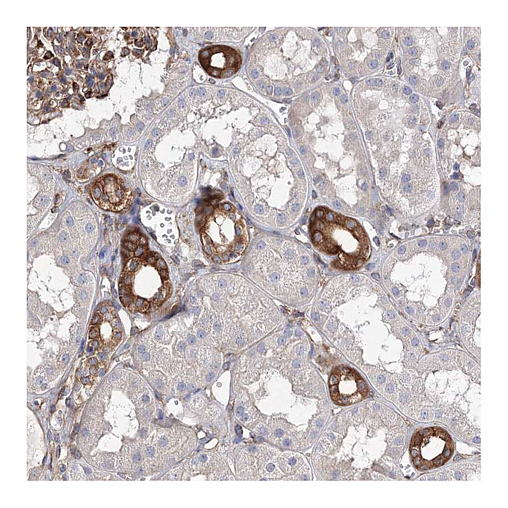 Atlas Antibodies Anti-SNX18 Antibody