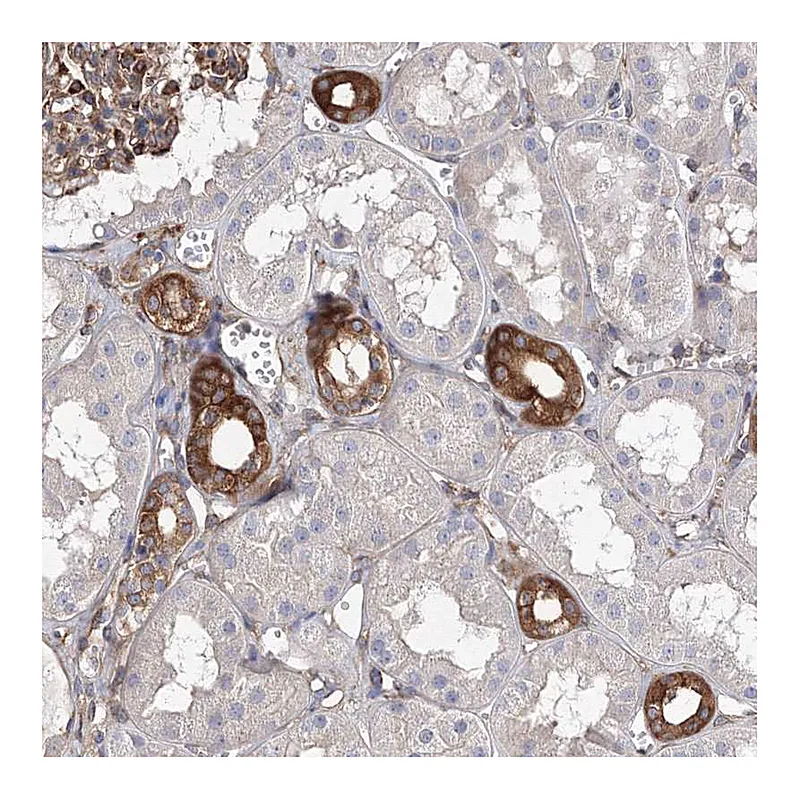 Atlas Antibodies Anti-SNX18 Antibody