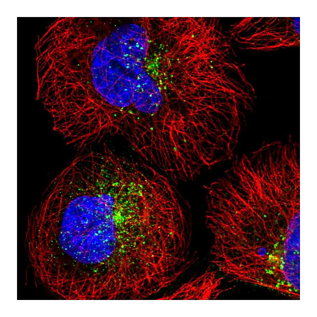 Atlas Antibodies Anti-SNX17 Antibody