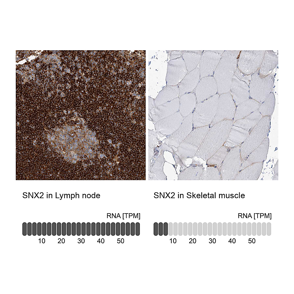Atlas Antibodies Anti-SNX2 Antibody