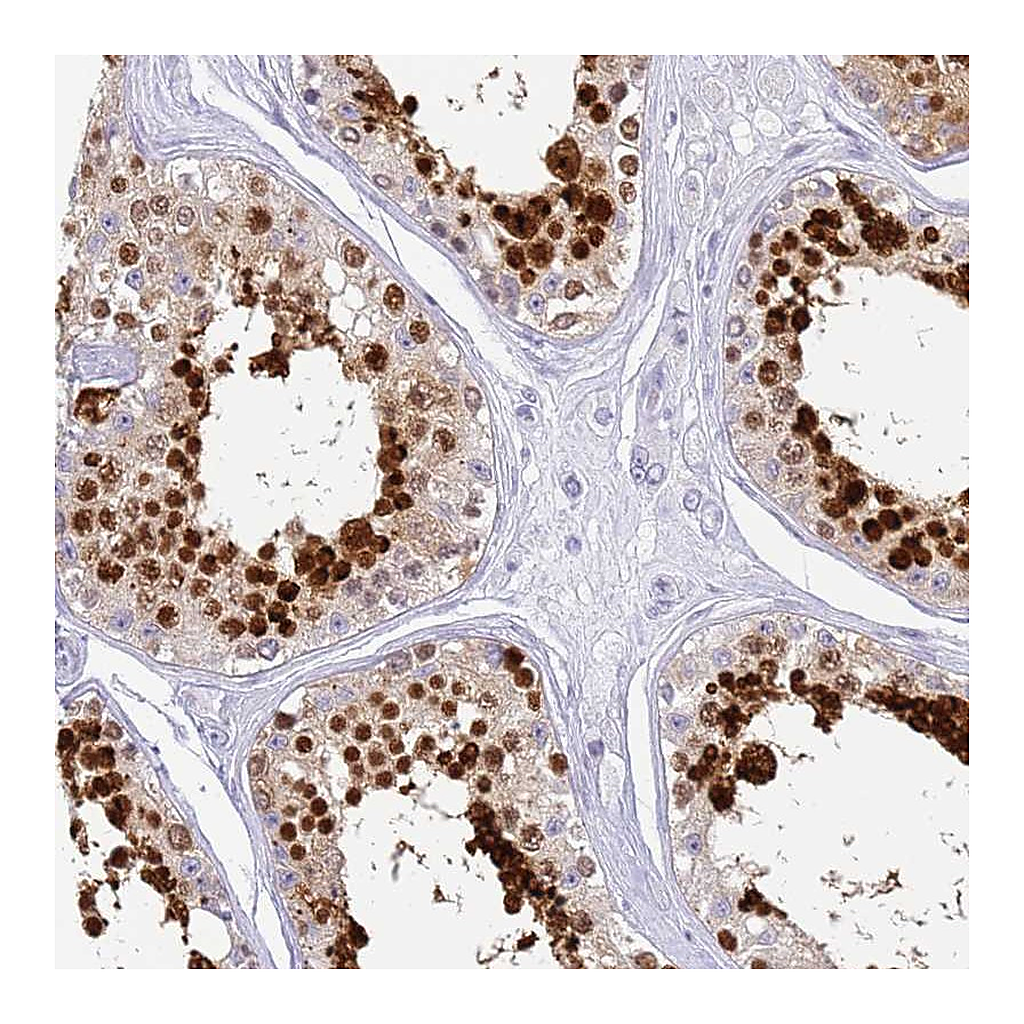 Atlas Antibodies Anti-SNX20 Antibody