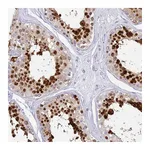Atlas Antibodies Anti-SNX20 Antibody