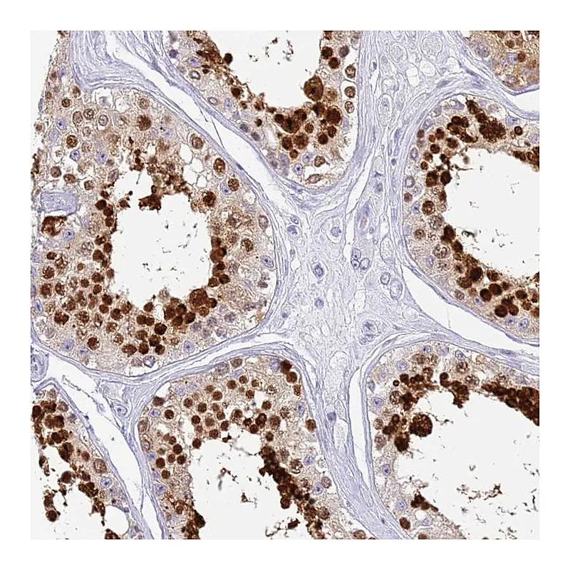 Atlas Antibodies Anti-SNX20 Antibody