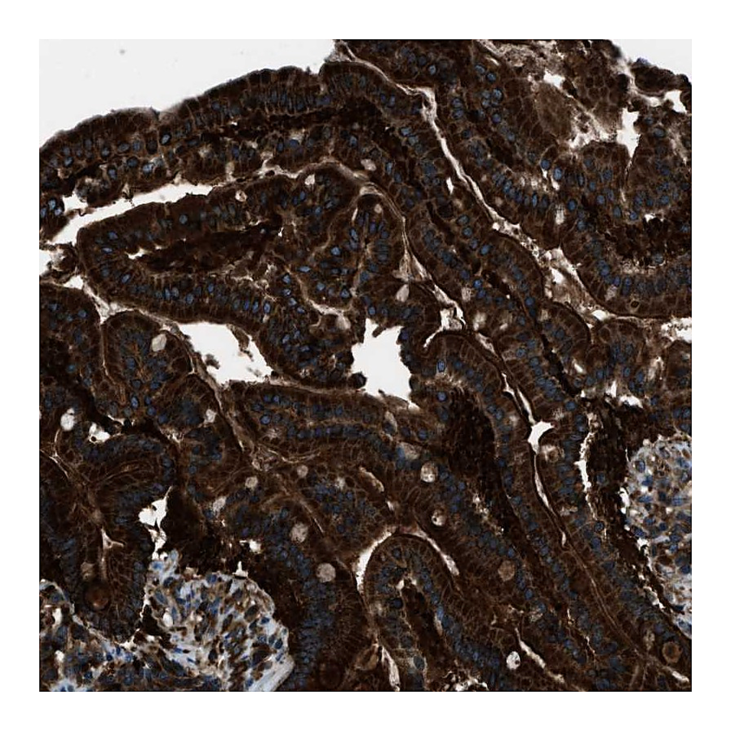 Atlas Antibodies Anti-SNX30 Antibody