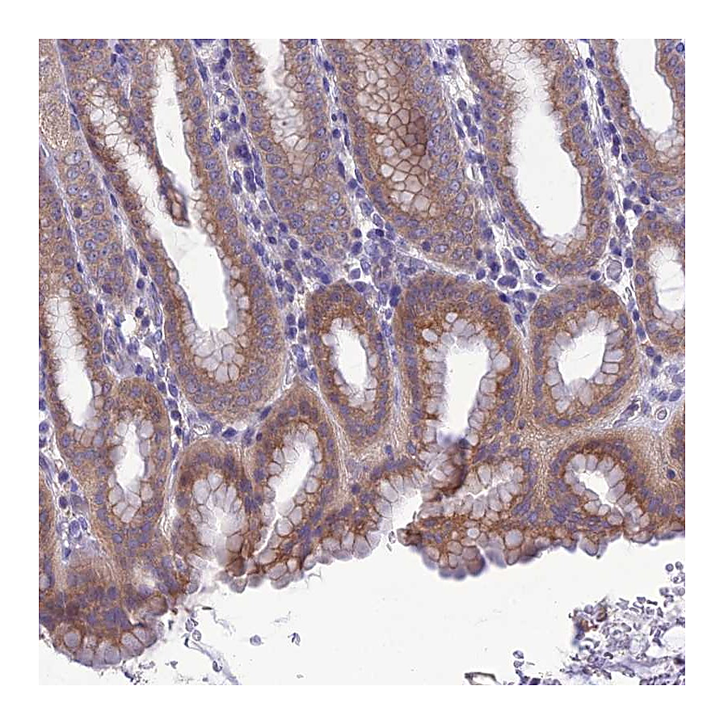 Atlas Antibodies Anti-SNX24 Antibody