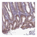 Atlas Antibodies Anti-SNX24 Antibody