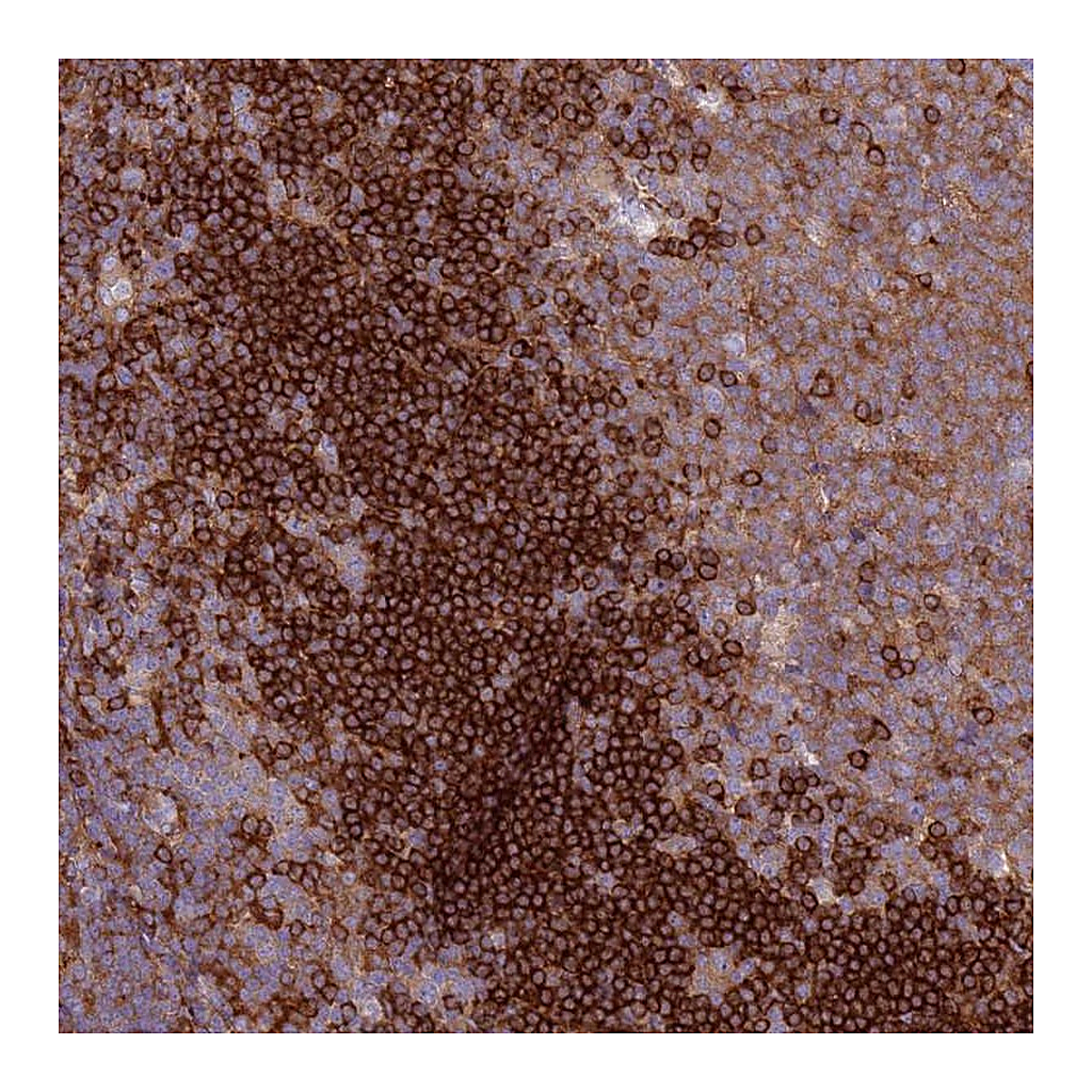 Atlas Antibodies Anti-SNX21 Antibody