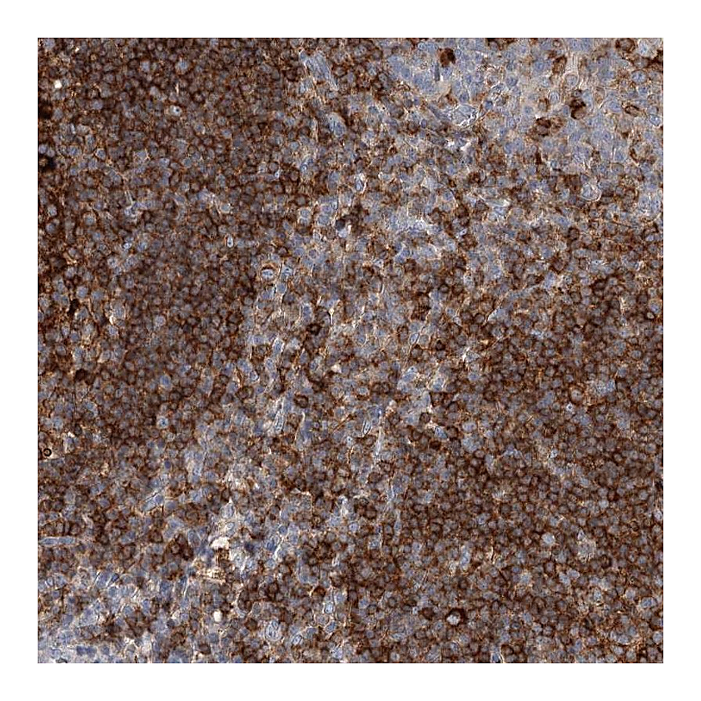 Atlas Antibodies Anti-SNX22 Antibody