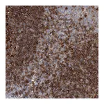 Atlas Antibodies Anti-SNX22 Antibody