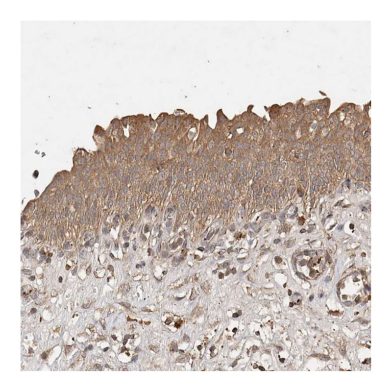 Atlas Antibodies Anti-SNX31 Antibody